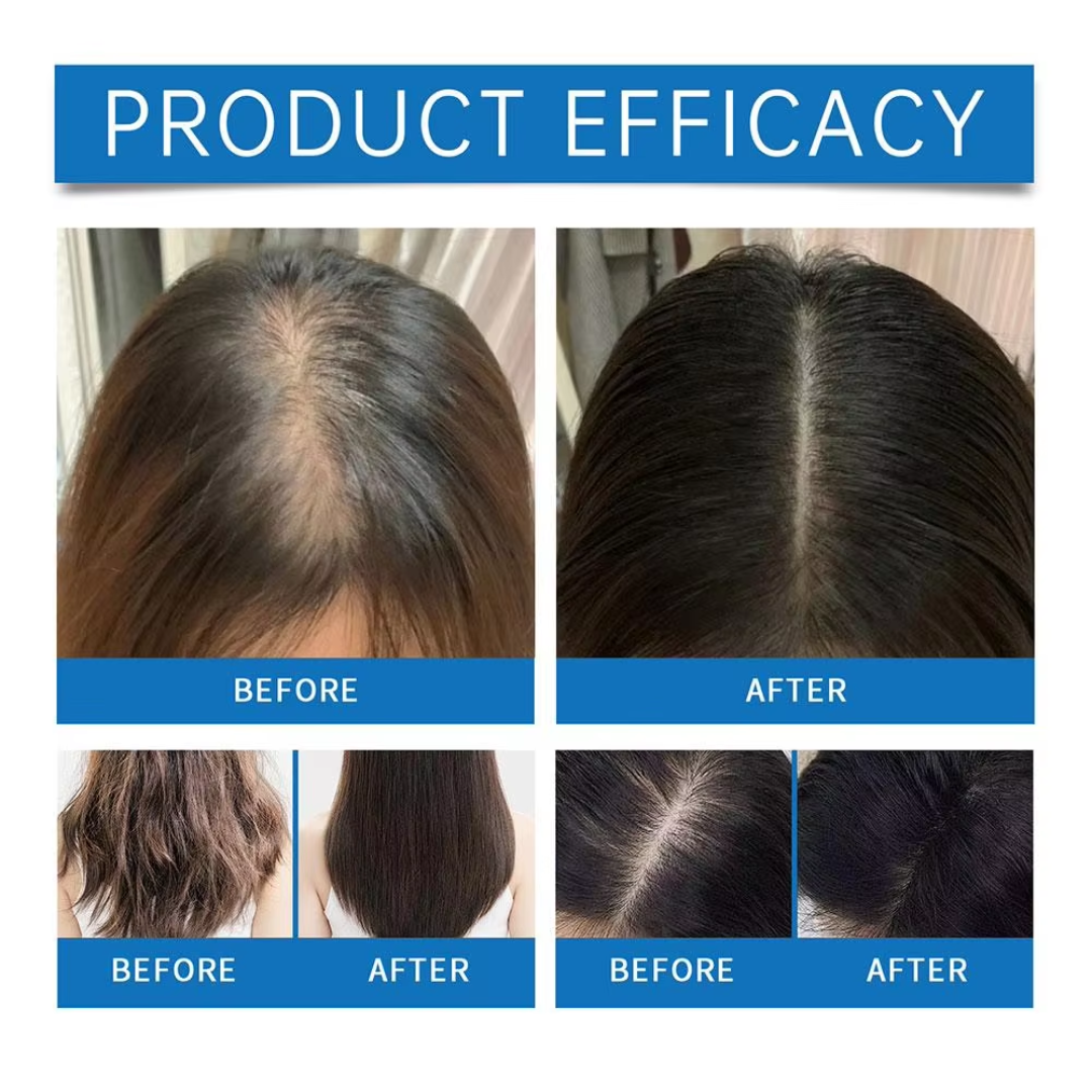 🌬️ Scalp Refresh Roller – Nourish, Strengthen, Grow! 🌟